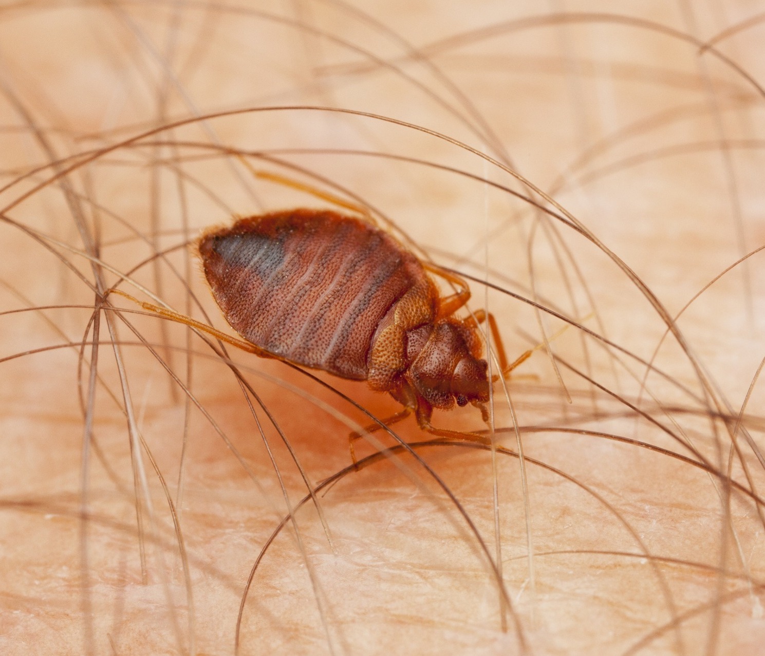 Bedbug on skin
